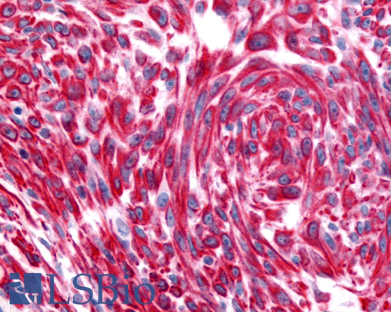 PathPlus™ Polyclonal Rabbit anti-Human CHRM2 / M2 Antibody (Cytoplasmic Domain, IHC)