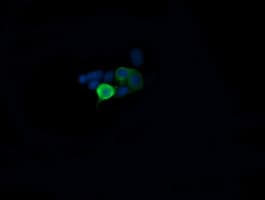 MAP2K1 / MKK1 / MEK1 Antibody (clone OTI4B1)