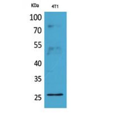 PathPlus™ CD81 Antibody (90-210 aa, Internal)