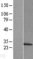PSMB6 Protein (Over-Expression Lysate Myc-DDK (Flag))