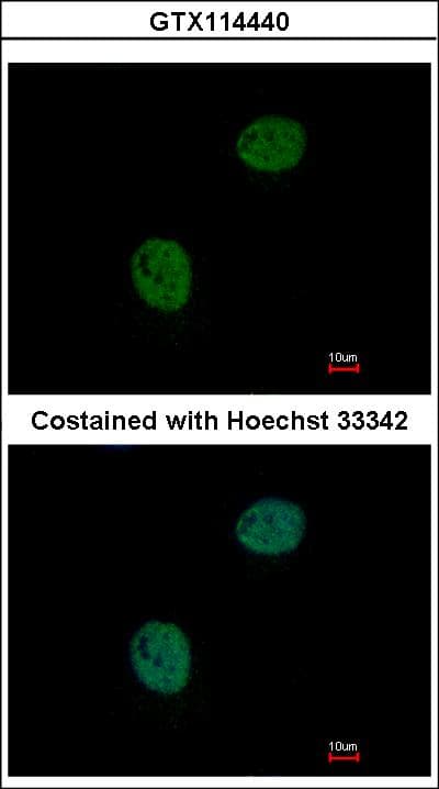 GNAT2 Antibody (aa154-354)