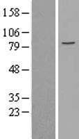 Human MCM5 Protein (Over-Expression Lysate Myc-DDK (Flag))