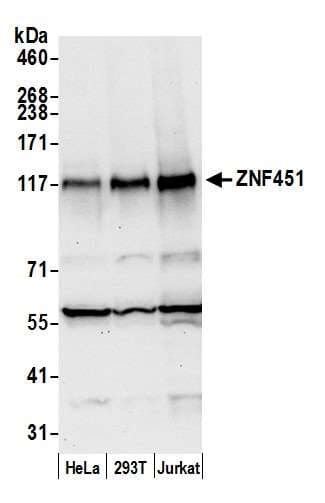 ZNF451 Antibody (aa1011-1061)