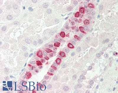 Polyclonal Rabbit anti-Human RBM5 / G15 Antibody (N-Terminus, IHC, WB)