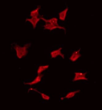Polyclonal Rabbit anti-Human RASSF6 Antibody (IF, WB)