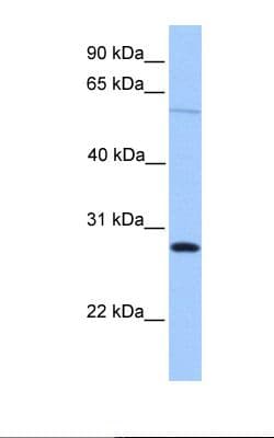 CBLN4 / Cerebellin 4 Antibody (aa125-174)