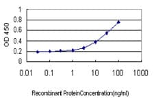 Monoclonal Mouse anti-Human LOXL2 Antibody (clone 5D2, WB)