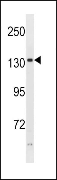 Polyclonal Rabbit anti-Human PHKA2 Antibody (aa285-314, WB)