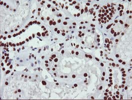 NONO / P54NRB Antibody (clone OTI3F8)