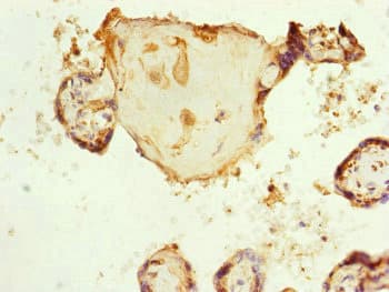 Polyclonal Rabbit anti-Human RNF139 / TRC8 Antibody (IHC)