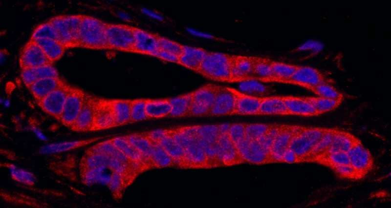 Polyclonal Rabbit anti-Human SRPK2 Antibody (aa425-475, IHC, IF)