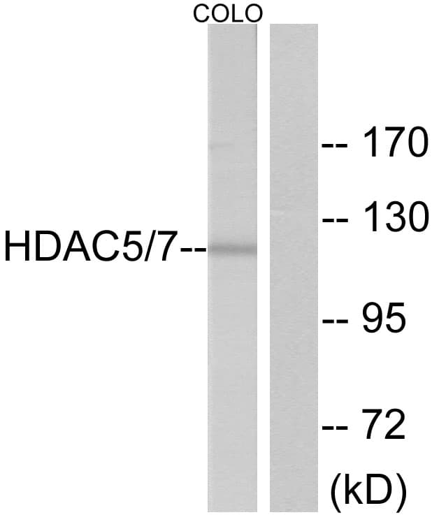 Polyclonal Rabbit anti-Human HDAC5 Antibody (aa464-513, IHC, WB)