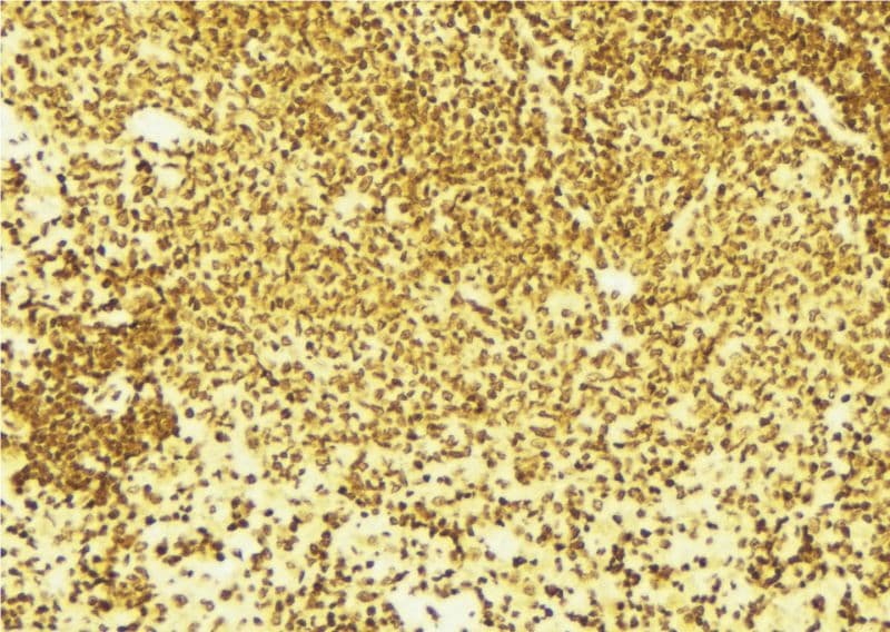 Polyclonal Rabbit anti-Human PPARG / PPAR Gamma Antibody (aa95-124, IHC, IF, WB)