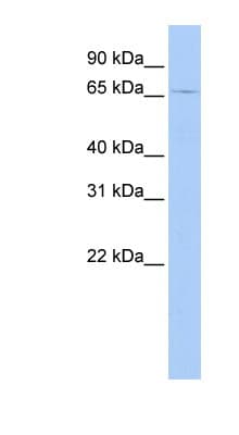 Polyclonal Rabbit anti-Human GSPT2 Antibody (aa144-193, WB)