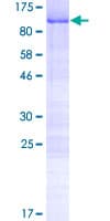 Human CCDC9 Protein (Recombinant GST)