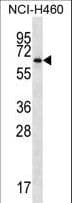 ZBTB46 Antibody (aa251-279)