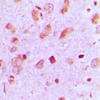 KRT13 / CK13 / Cytokeratin 13 Antibody (Internal)