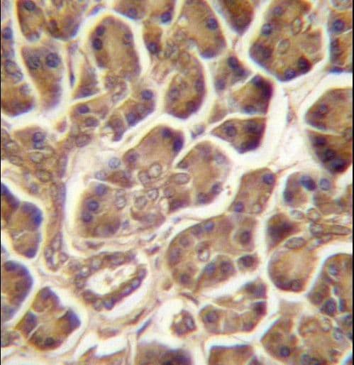 Polyclonal Rabbit anti-Human CSDC2 Antibody (aa76-105, IHC, WB)