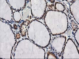 DSTN / Destrin Antibody (clone OTI2C10)