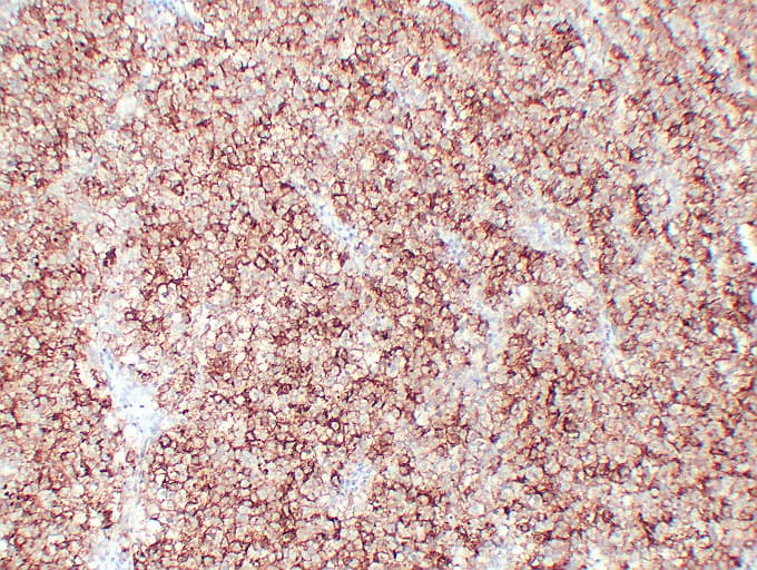 PathPlus™ PLAP / Alkaline Phosphatase Antibody