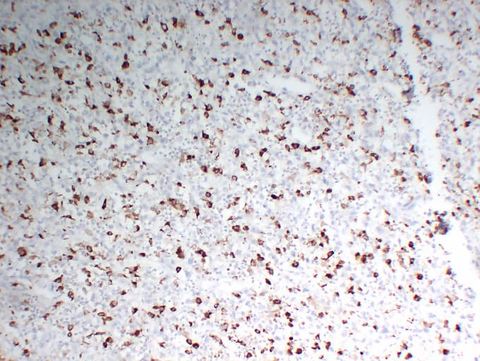 CD68 Antibody (clone ABT-CD68)