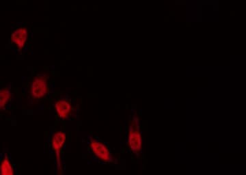 Polyclonal Rabbit anti-Human CDC25A Antibody (phospho-Ser124, IHC, IF, WB)