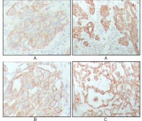KRT8 / CK8 / Cytokeratin 8 Antibody (aa391-483, clone 8A5D12)