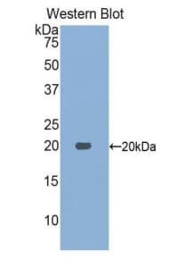 ACP1 / Acid Phosphatase Antibody (aa1-158)