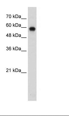 Polyclonal Rabbit anti-Human BAF60B / SMARCD2 Antibody (aa440-489, IHC, WB)
