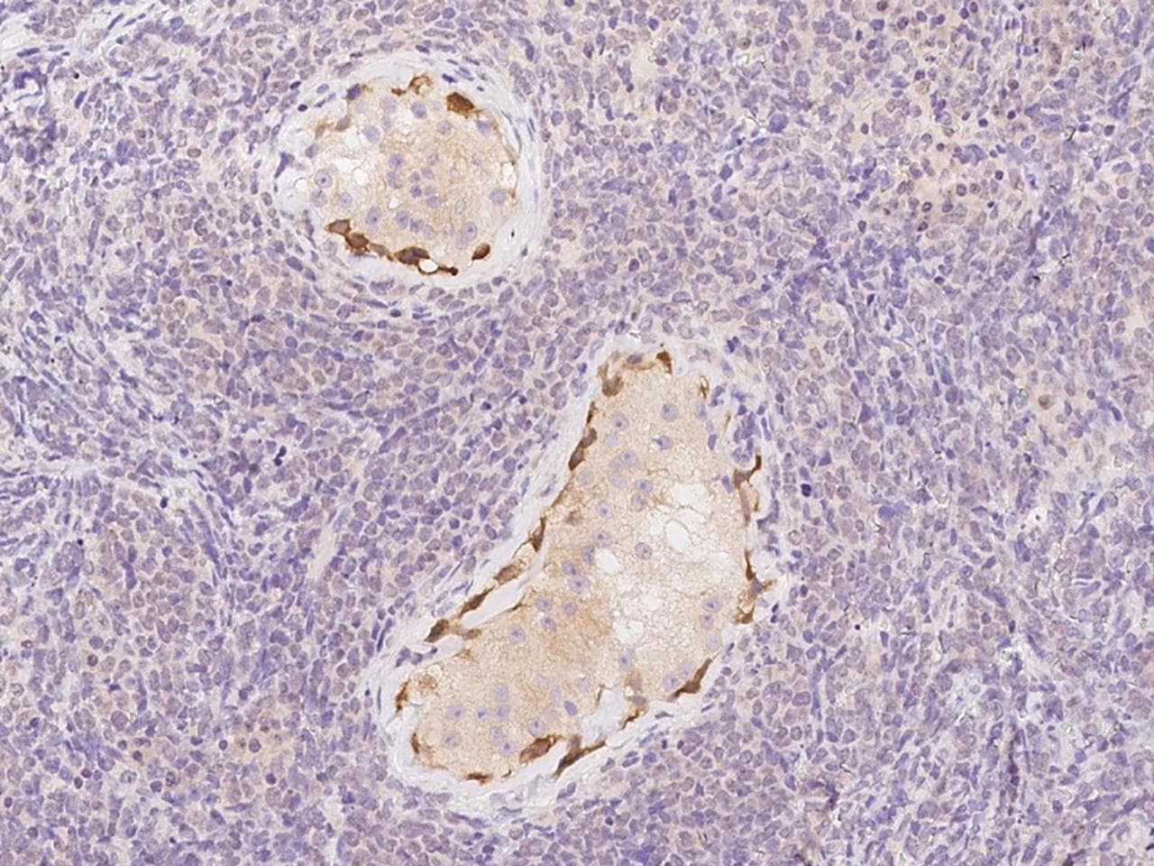 DDHD1 Antibody