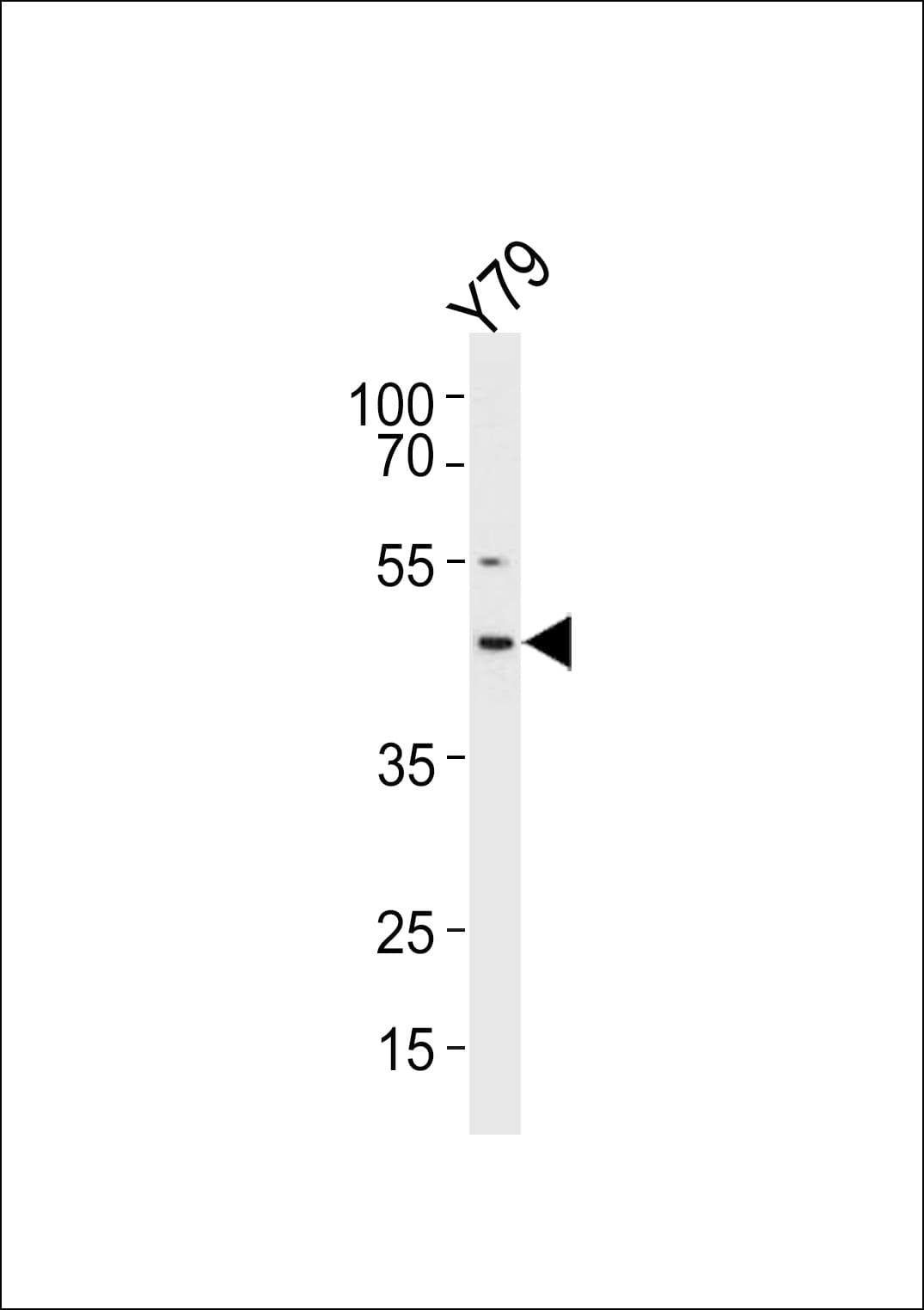 RDH10 Antibody (aa106-135)