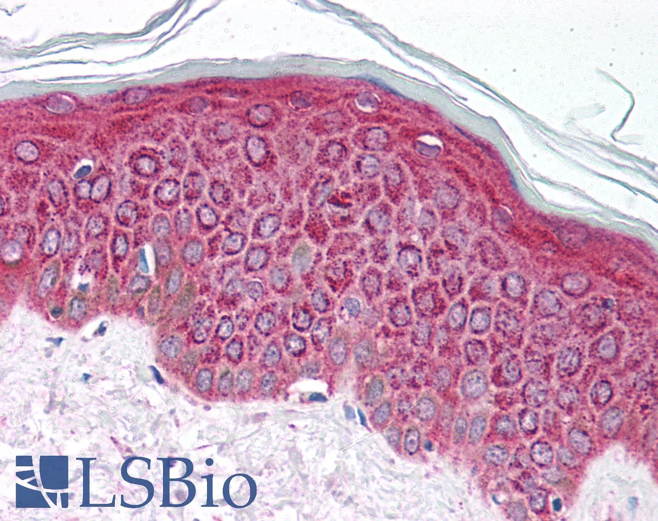 Polyclonal Rabbit anti-Human PEA3 / ETV4 Antibody (aa181-230, IHC, WB)