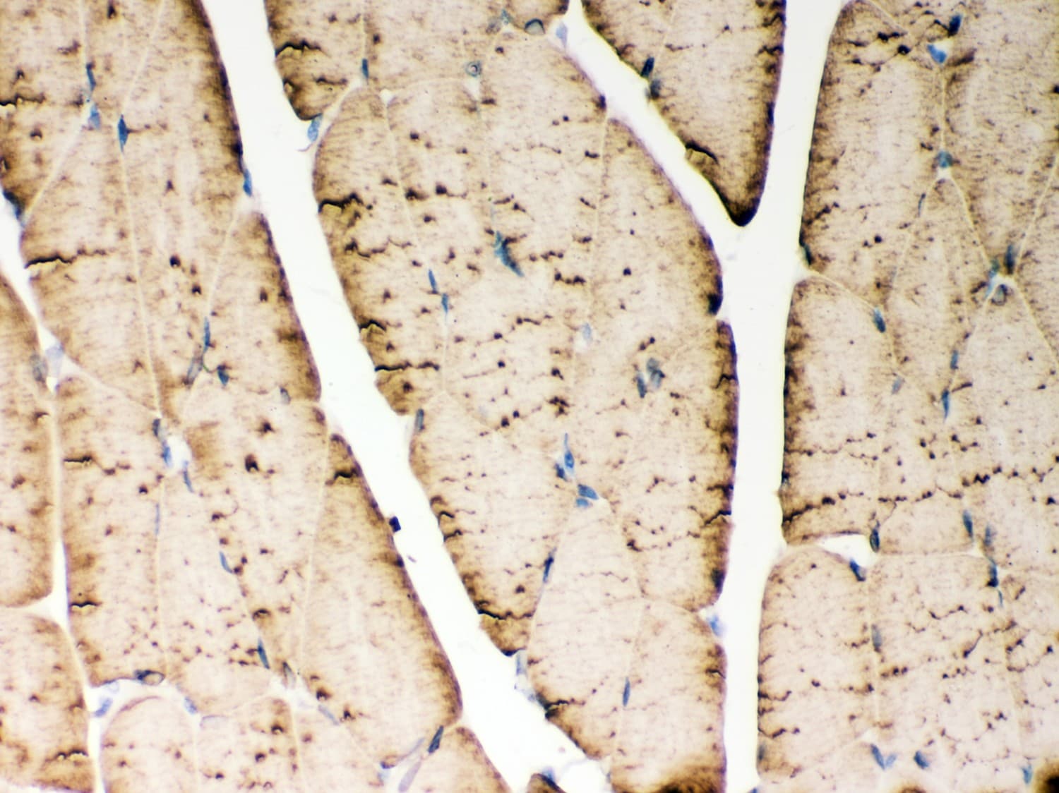 ATP2A1 / SERCA1 Antibody (aa1-32)