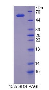 Human MRE11A / MRE11 Protein (Recombinant His-GST)