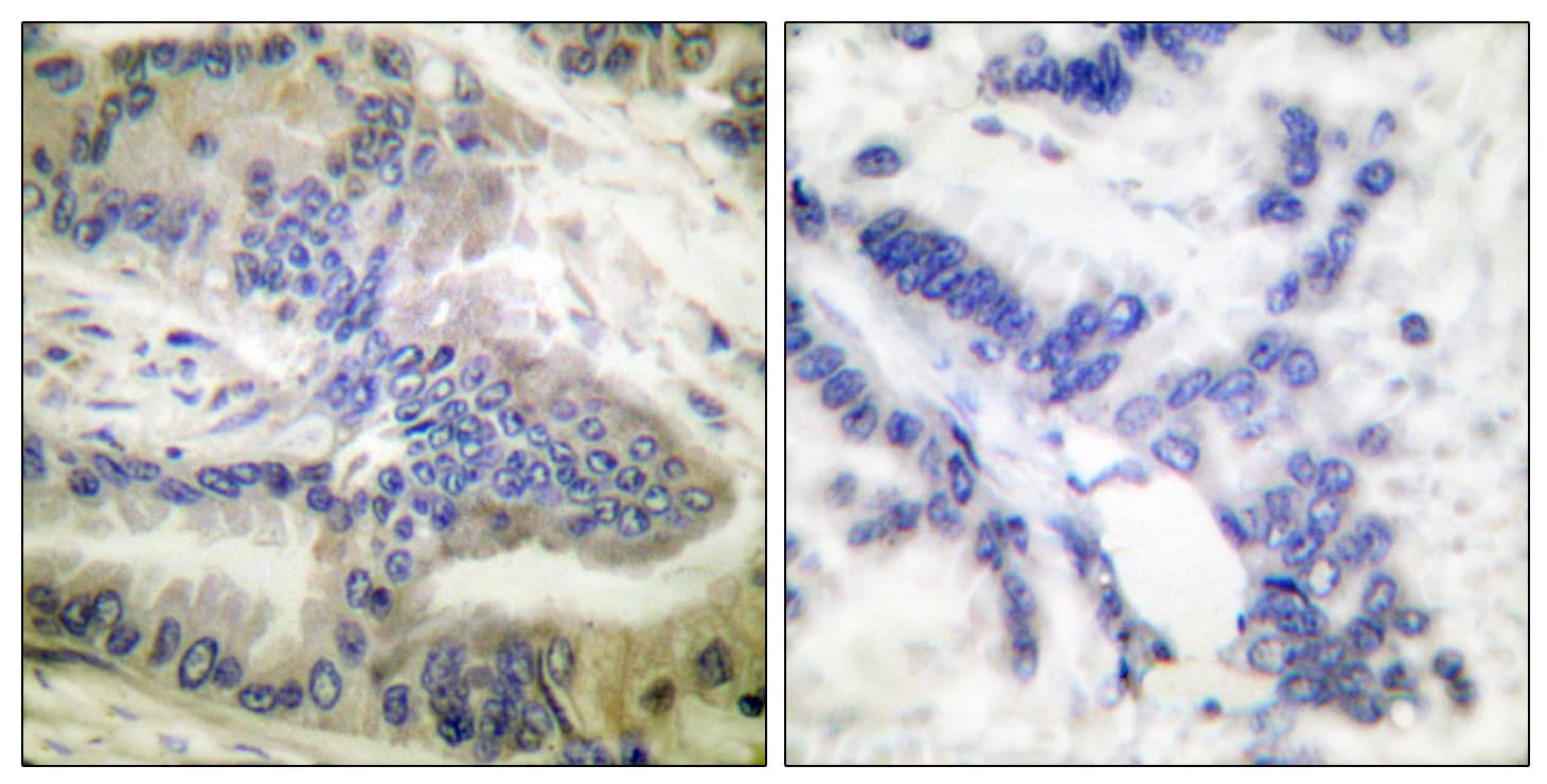 Polyclonal Rabbit anti-Human CASP6 / Caspase 6 Antibody (phospho-Ser257, IHC, IF, WB)