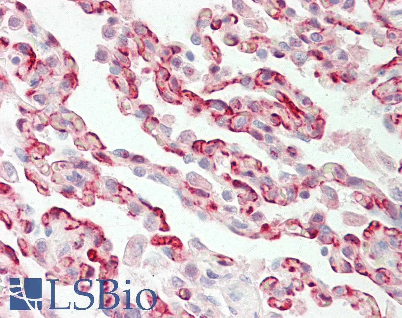 IHC-plus™ FBXL5 / FBL5 Antibody (aa510-691)