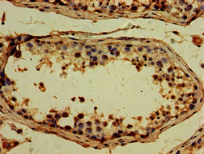 Polyclonal Rabbit anti-Human TTLL6 Antibody (IHC)
