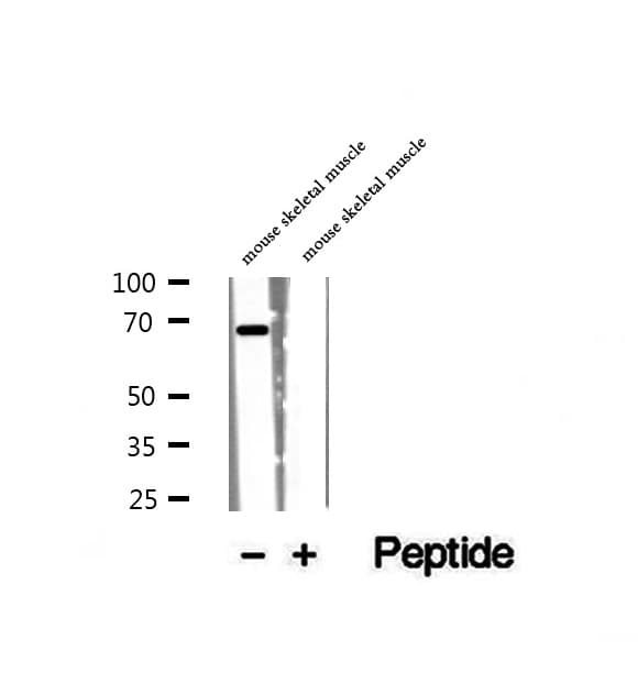 WDR1 Antibody