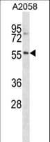NACC2 / BTBD14A Antibody (aa473-502)