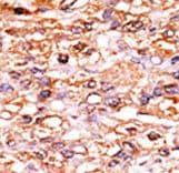 CDKN1B / p27 Kip1 Antibody (phospho-Ser178)