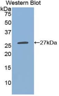 CLEC10A / CD301 Antibody (aa69-273)