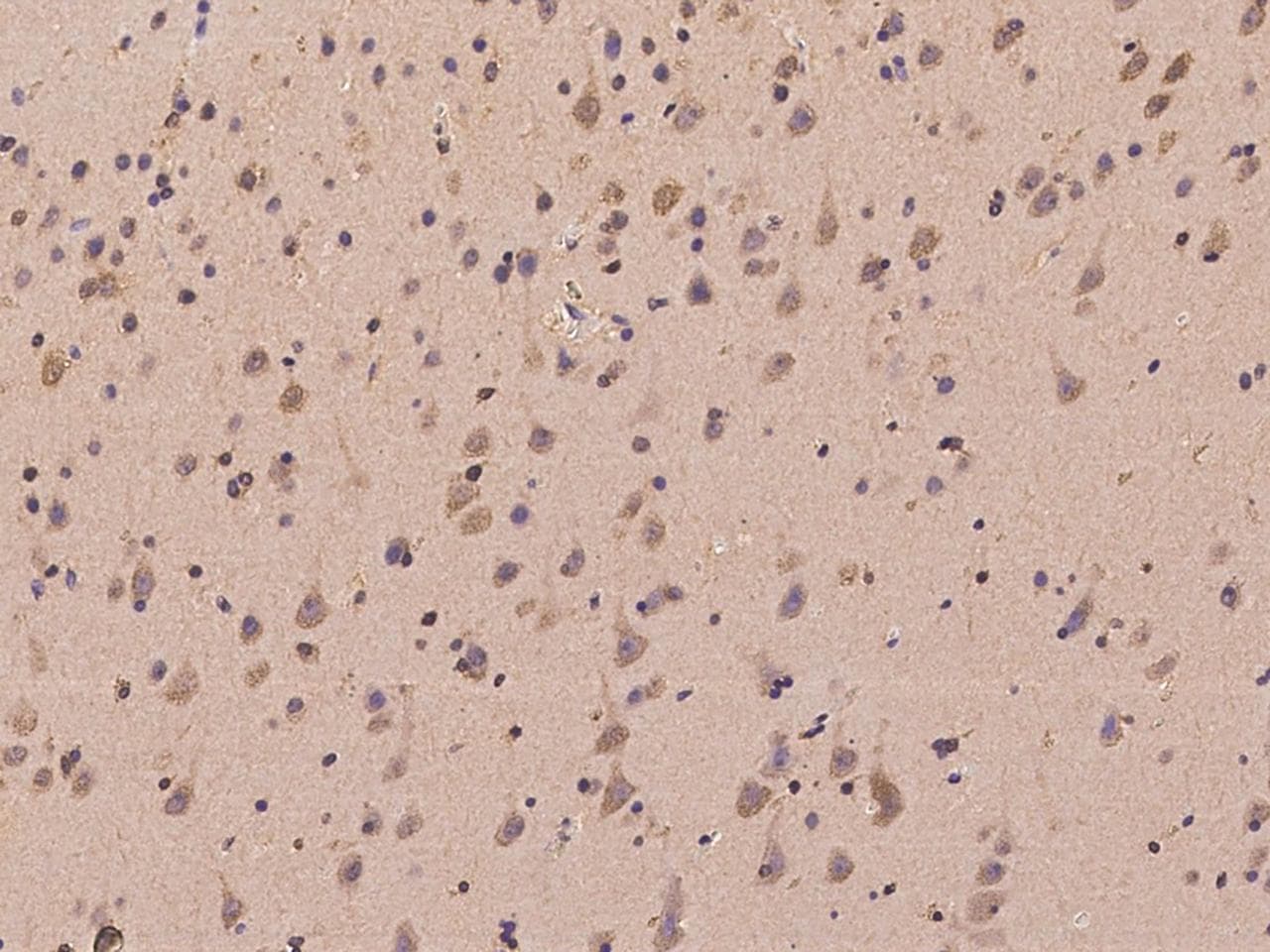 PARP10 Antibody