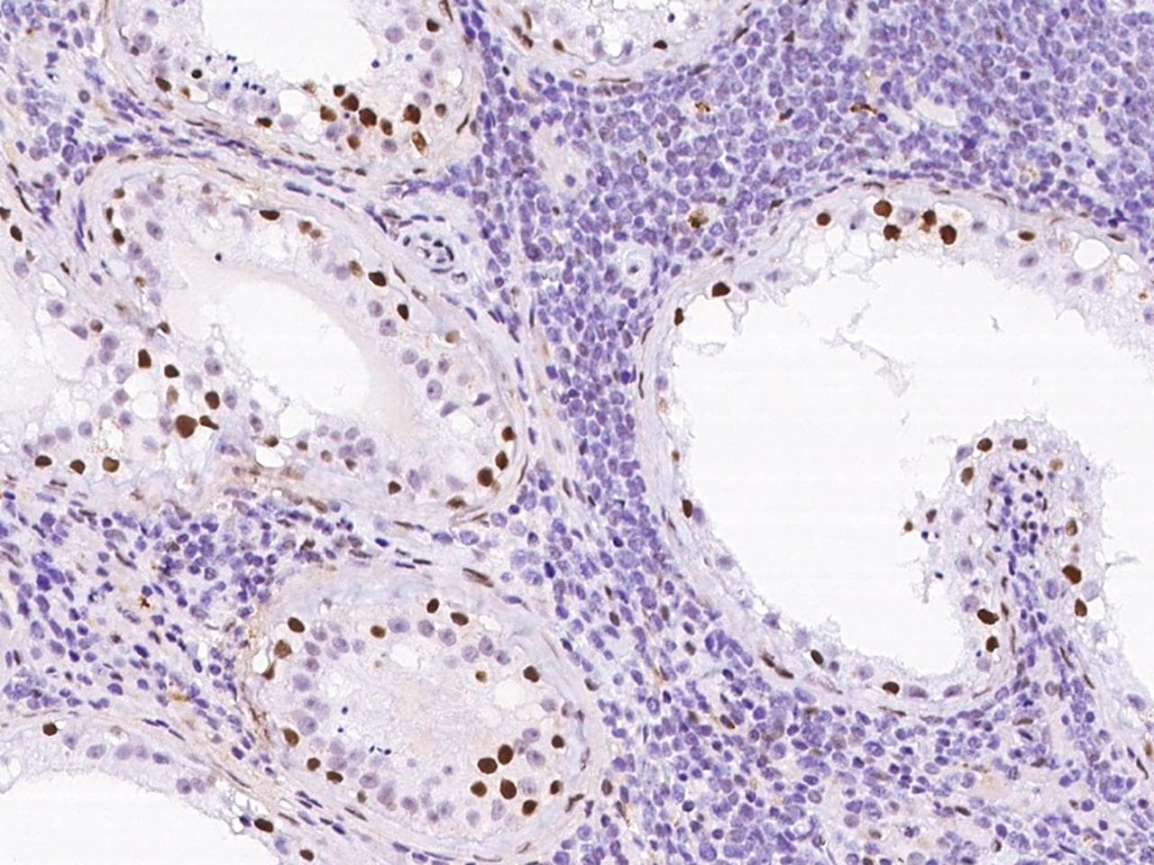 CBX1 / HP1 Beta Antibody