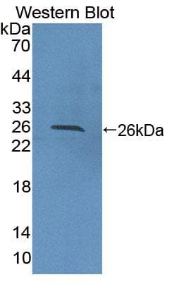 PTPN21 / PTPD1 Antibody (HRP)