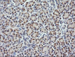 CTAG1B / NY-ESO-1 Antibody (clone OTI4D8)