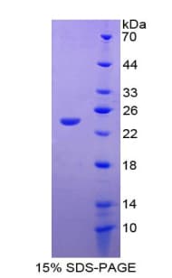 Rat HMG1 / HMGB1 Protein (Recombinant His)
