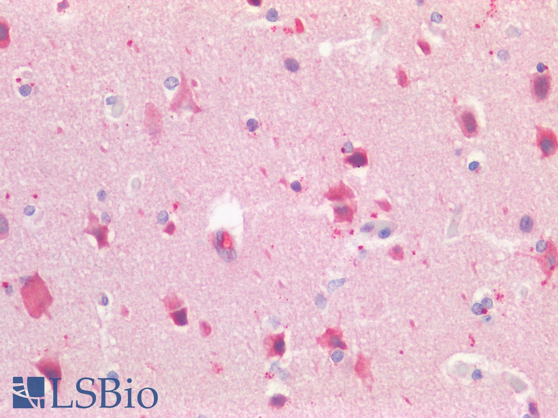 PathPlus™ Polyclonal Rabbit anti-Human GPR49 / LGR5 Antibody (Cytoplasmic Domain, IHC, IF)