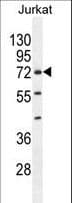Polyclonal Rabbit anti-Human ZNF648 Antibody (aa41-69, WB)
