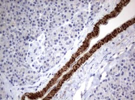 Hamartin / TSC1 Antibody (clone OTI3A2)