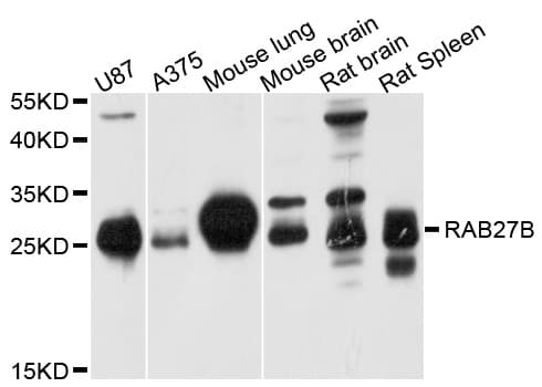 Polyclonal Rabbit anti-Human RAB27B Antibody (WB)